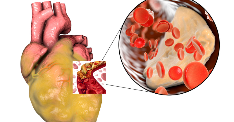 5 Surprising Foods That Could Be Hurting Your Heart